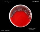 Yersinia pestis colonies on blood agar